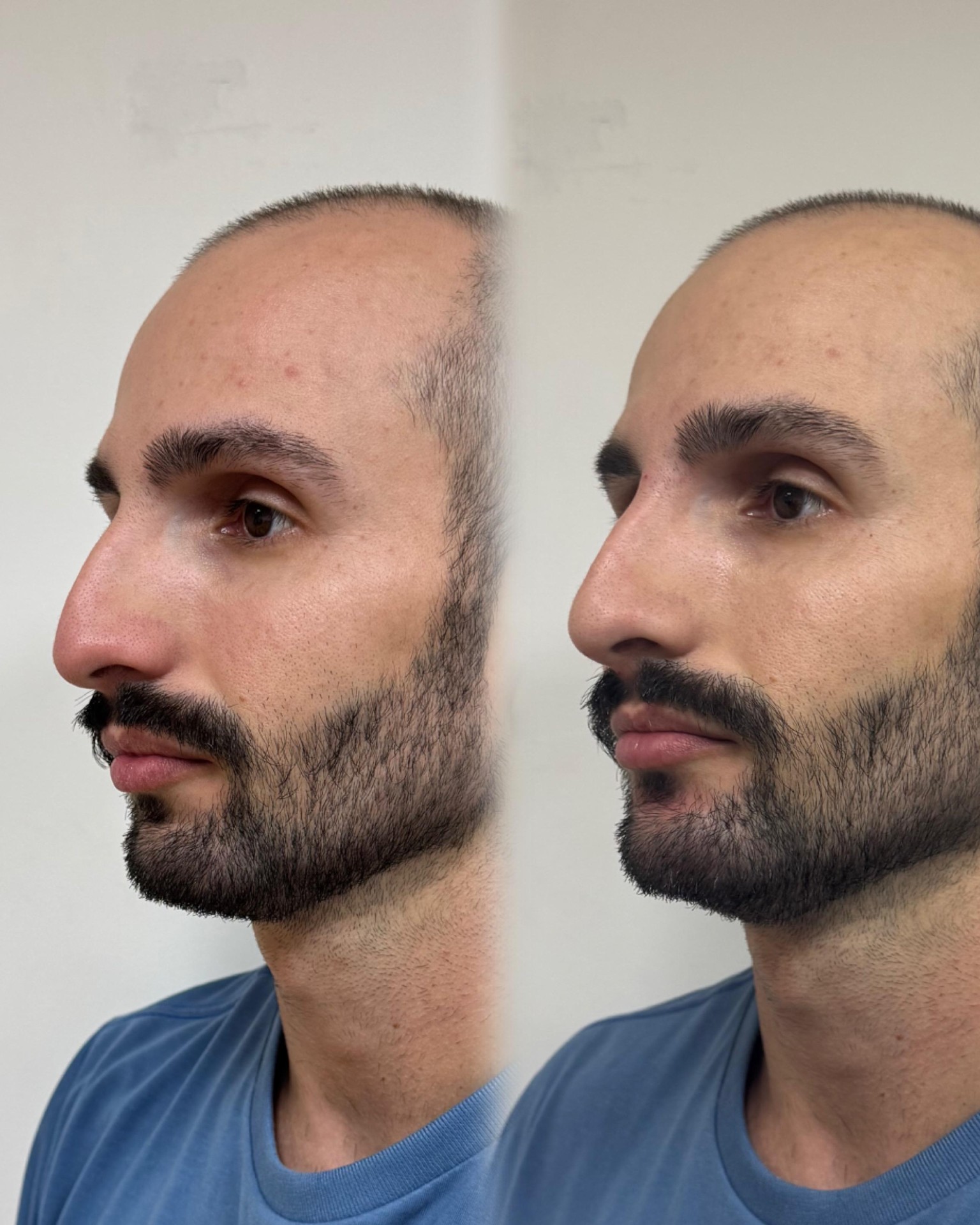 Antes e depois 3